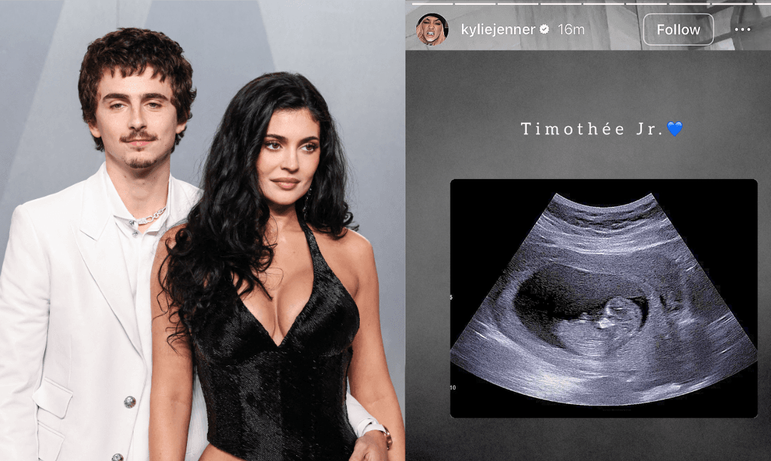 ¿Kylie Jenner ya espera a “Timothée Jr.? Esto sabemos del rumor