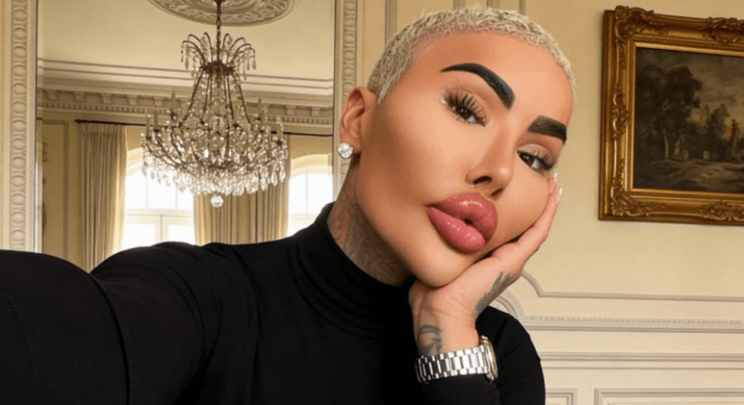Ken Kardashian: Muere influencer que intentaba ser como Kim