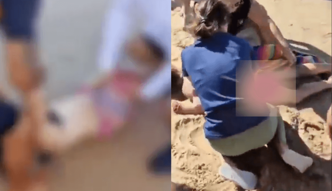 VIDEO: Joven pierde una pierna tras ataque de tiburón en Brasil