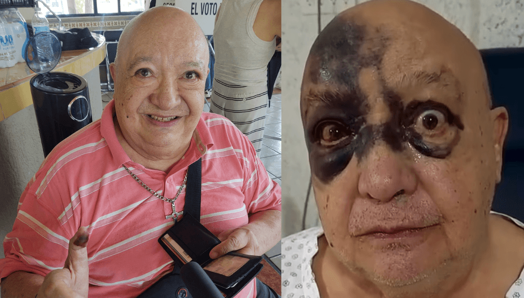 ¿Luis de Alba está bien? Estos sabemos de suestado de salud