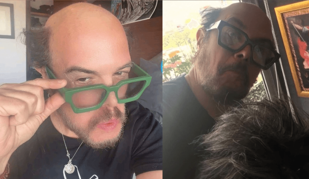 Aleks Syntek sorprende a todos al mostrarse sin peluquín