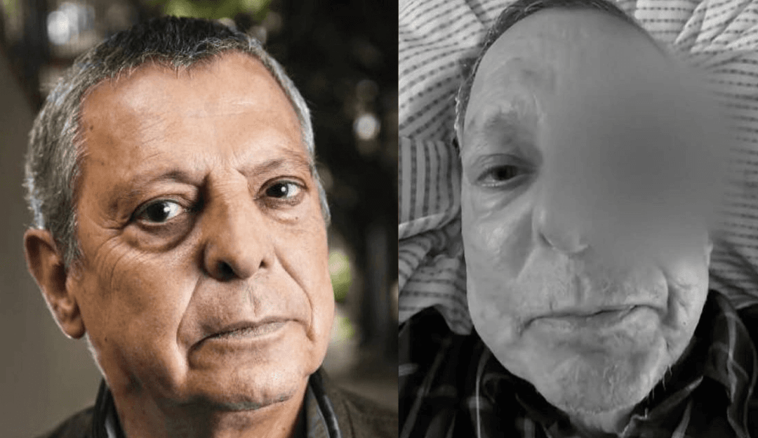 ¿César Bono perdió su ojo? Esto sabemos de la noticia